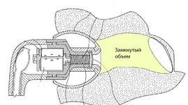 Вакуумные наушники